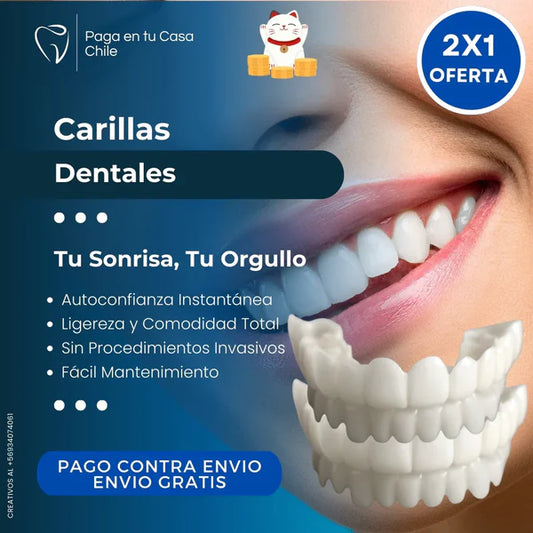 Carillas HappySmile dentales